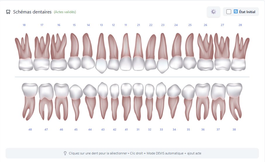Schéma dentaire Prodents — vue 32 dents en notation FDI